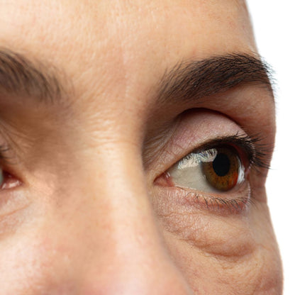 Soro para Bolsas e Olheiras