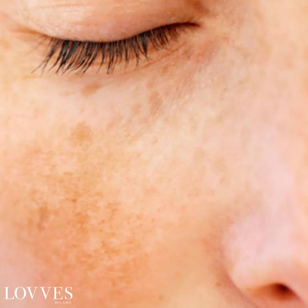 Soro Iluminador Manchas Rosto Despigmentante