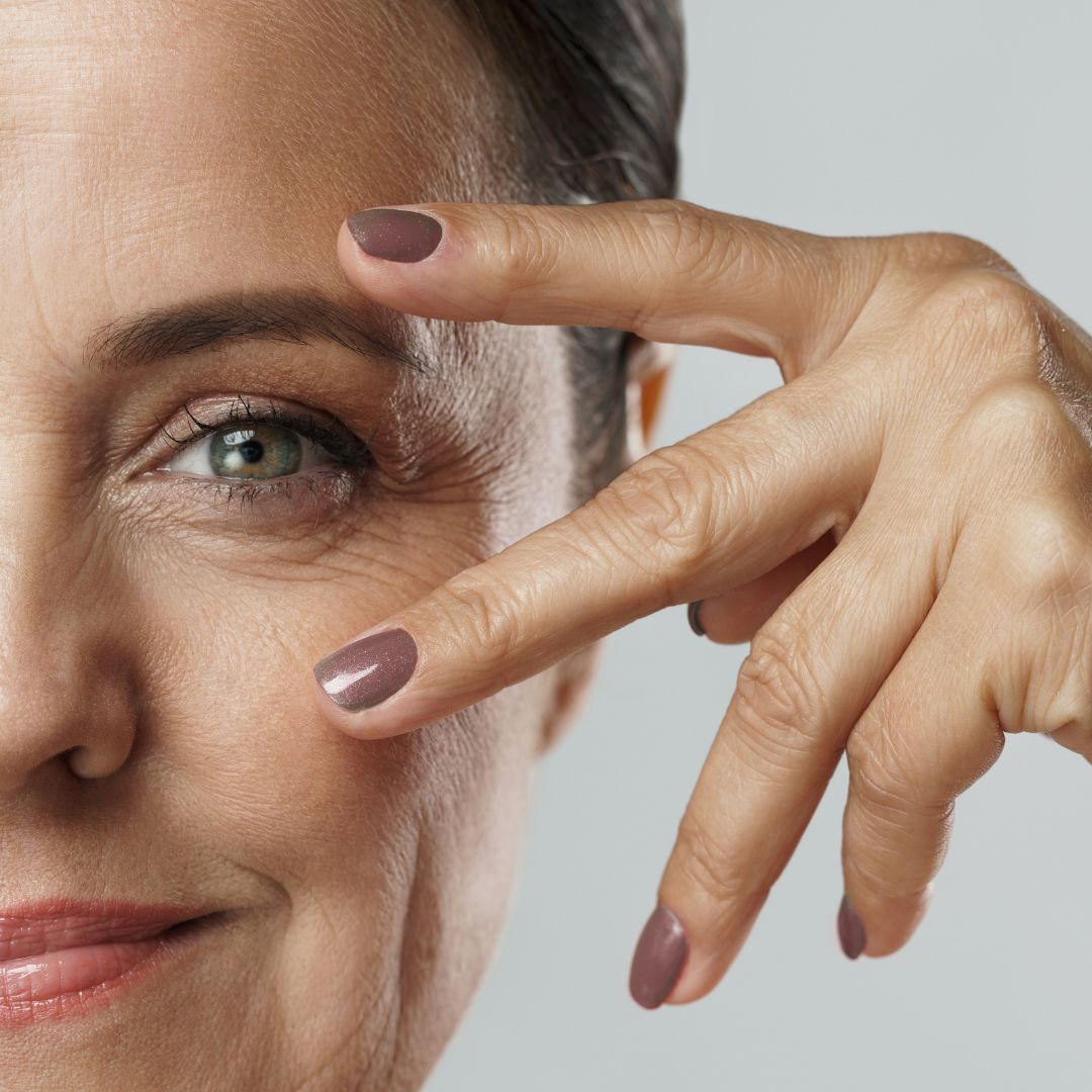 Soro para Bolsas e Olheiras