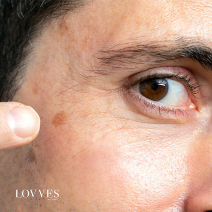 Soro Iluminador Manchas Rosto Despigmentante